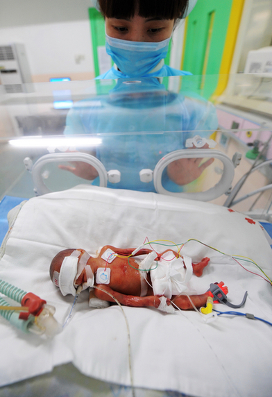 Tiny 500g baby born after 24 weeks in womb