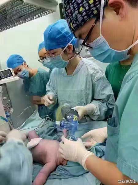 16 medical staff members help 140kg woman deliver baby