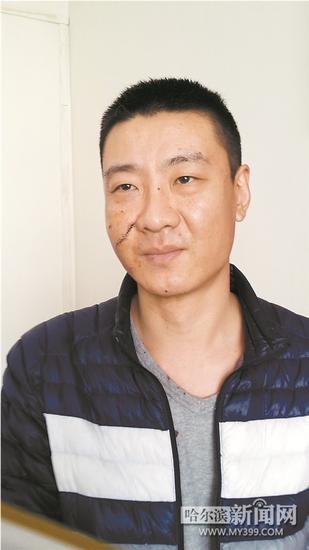 哈爾濱小伙一分鐘空手制伏持刀男子 全身縫21針(圖)