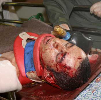 An injured Israeli soldier is rushed into the Soroka hospital in the southern Israeli city of Beersheva after being evacuated from Gaza Strip, October 28, 2004. [Reuters]