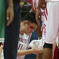 ouston Rockets center Yao Ming bleeds after being hit in the right eye by the elbow of Boston Celtics forward Brian Scalabrine in the second half of their NBA game in Houston December 6, 2005.