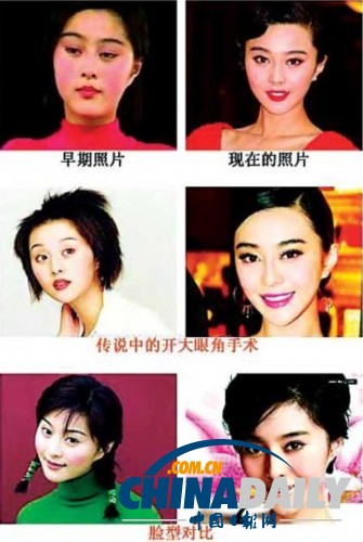 柳巖李小璐楊冪　女星整容前驚人對(duì)比照