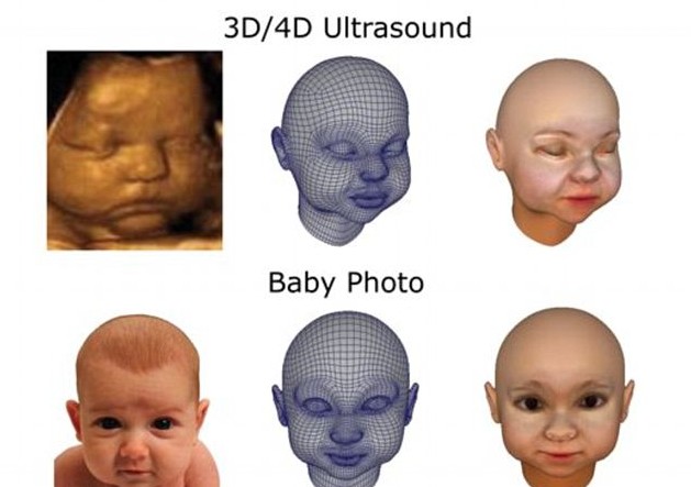 3D打印帶你見未出生胎兒！體位表情皮膚性別皆可見