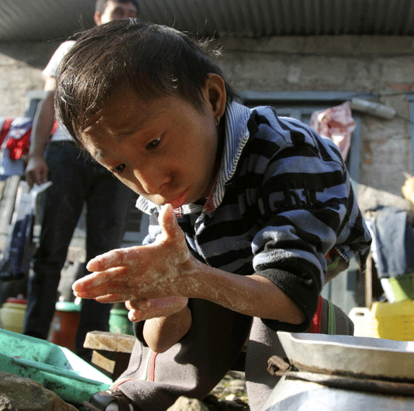 Nepal teen stands tall as world's shortest man