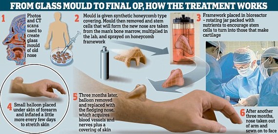 手臂上長出鼻子！人體器官再生技術(shù)獲突破